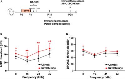 Multiple Sevoflurane Exposures During the Neonatal Period Cause Hearing Impairment and Loss of Hair Cell Ribbon Synapses in Adult Mice